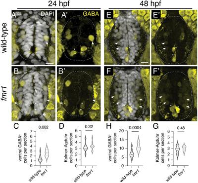 Fmrp regulates neuronal balance in embryonic motor circuit formation